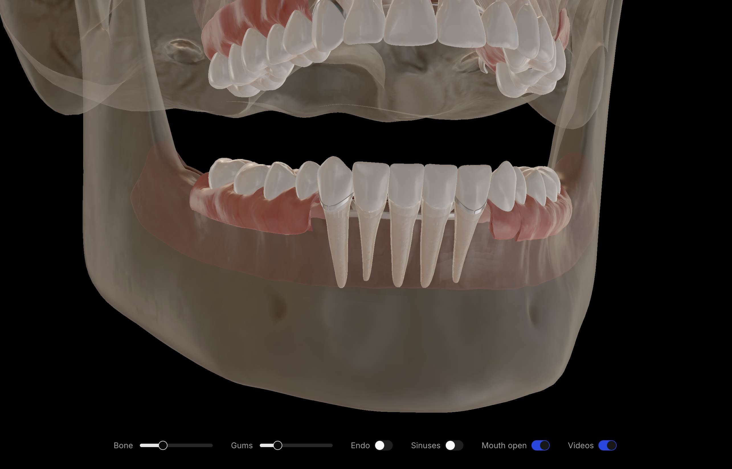 Anatomy layer controls in Lift