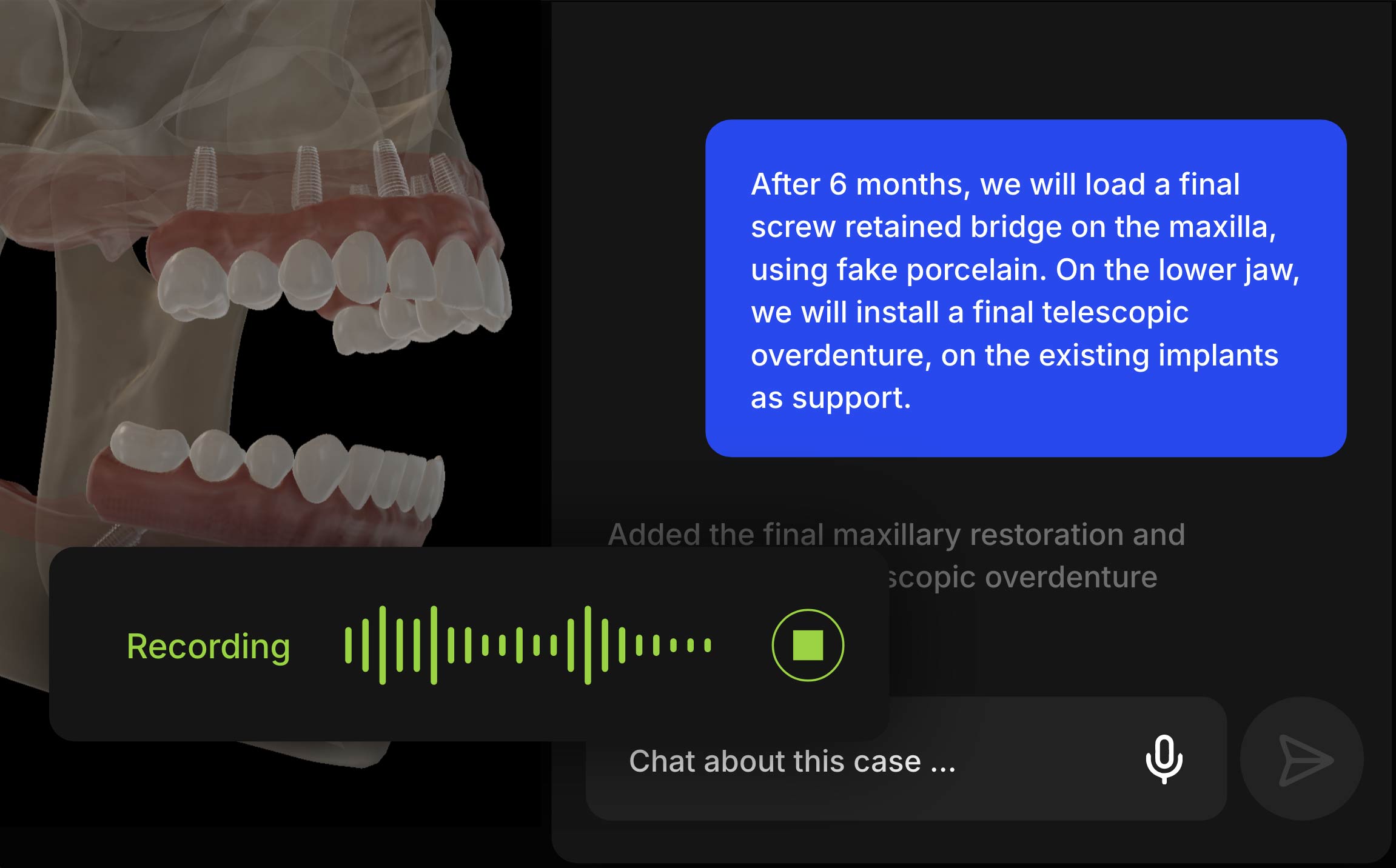 Describing a case in Lift by voice